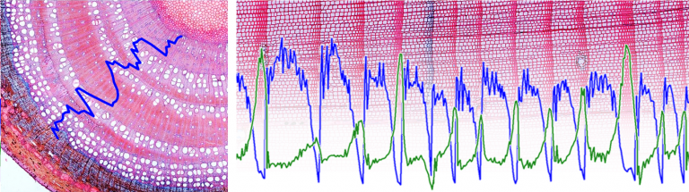 Images by Georg von Arx: image analysis of wood micrographs. Stained wood tihin sections with measurement graph overlays